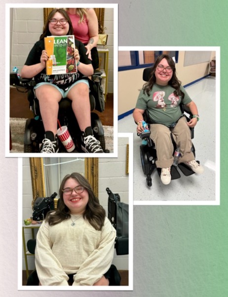 Ella before & after photos