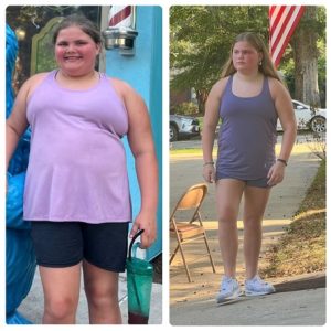 Kadence before & after photos