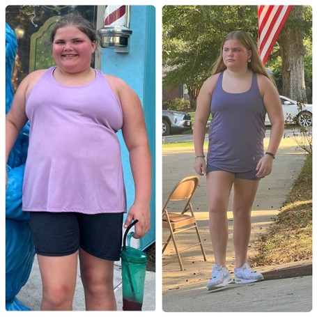 Kadence before & after photos
