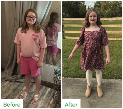Kaylee before & after photos
