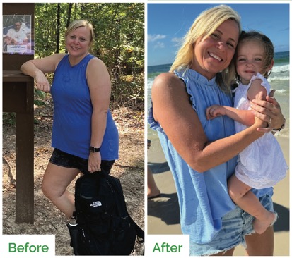 Before & after photo of Lisa