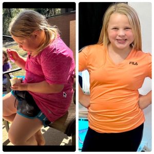 MyaKate before & after photos