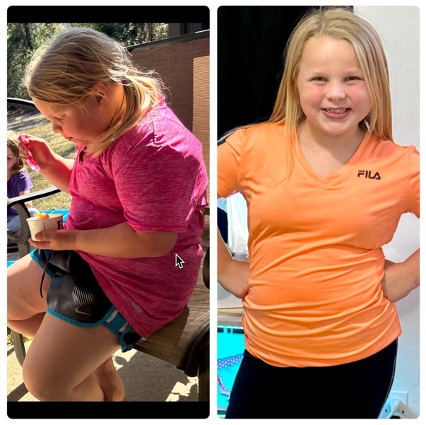 MyaKate before & after photos