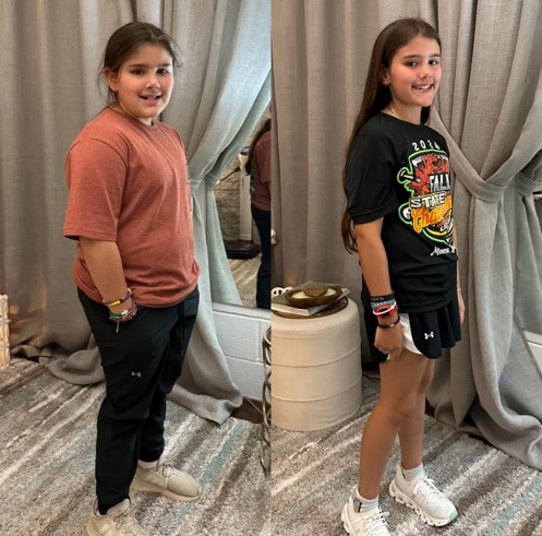 Before & after photos of Olivia (updated)