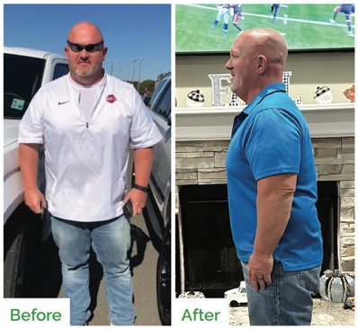 Ryan Norris before & after photos